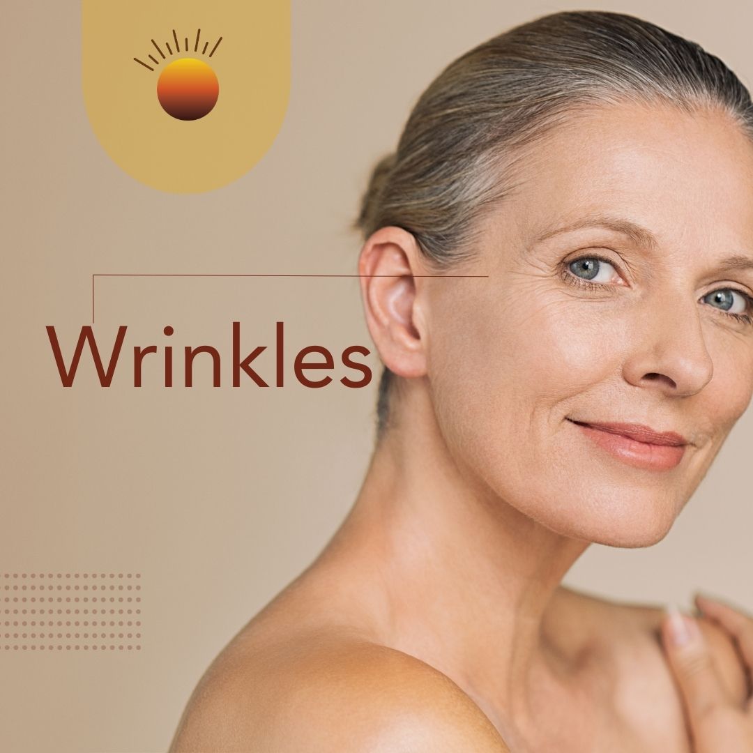 Wrinkles & Fine Lines